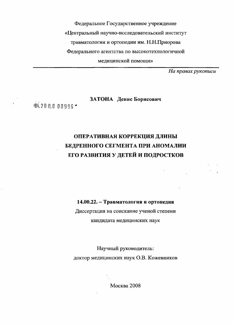 Оперативная коррекция длины бедренного сегмента при аномалии его развития у детей и подростков