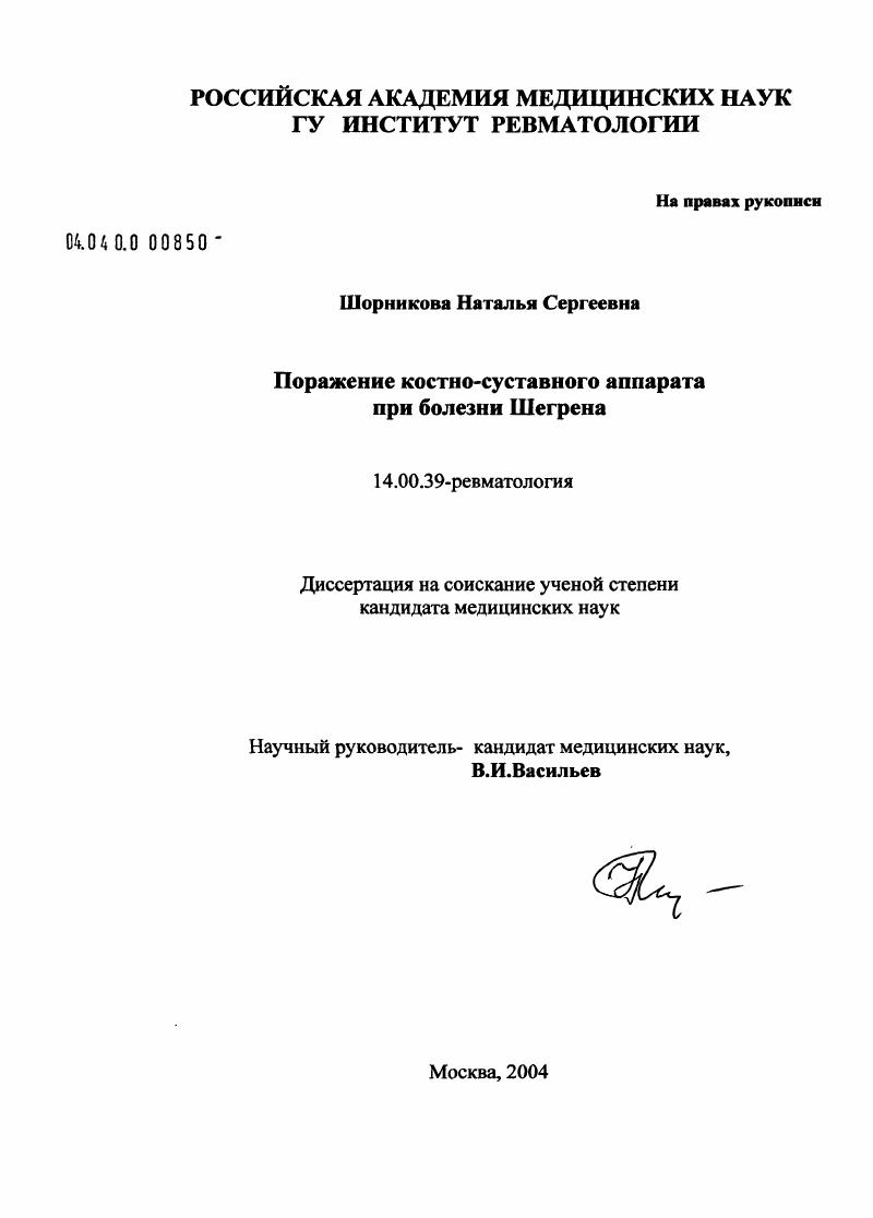 Поражение костно-суставного аппарата при болезни Шегрена