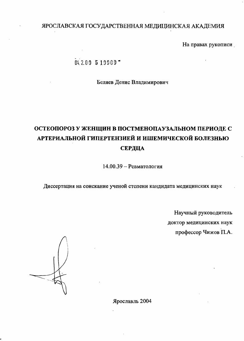 Остеопороз у женщин в постменопаузальном периоде с артериальной гипертензией и ишемической болезнью сердца