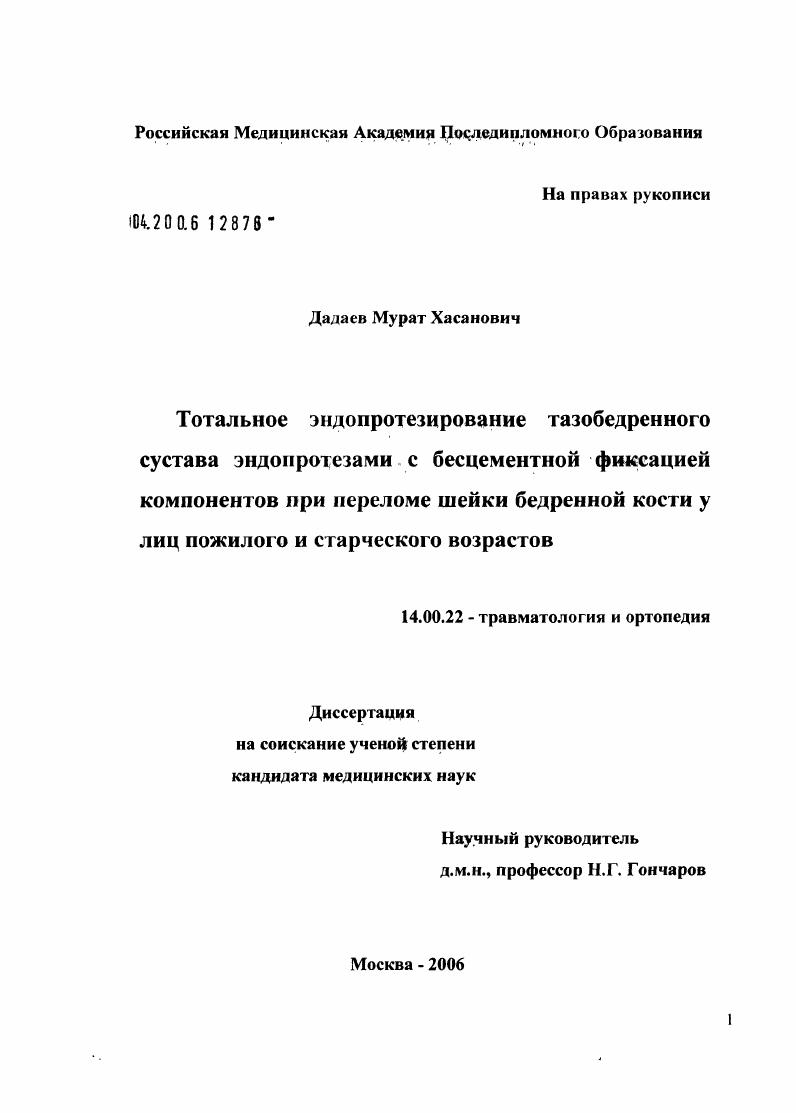 Тотальное эндопротезирование тазобедренного сустава эндопротезами с бесцементной фиксацией компонентов при переломе шейки бедренной кости у лиц пожилого и старческого возрастов