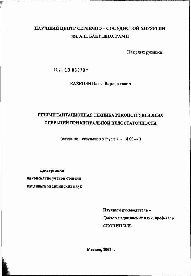 Безымплантационная техника реконструктивных операций при митральной недостаточности